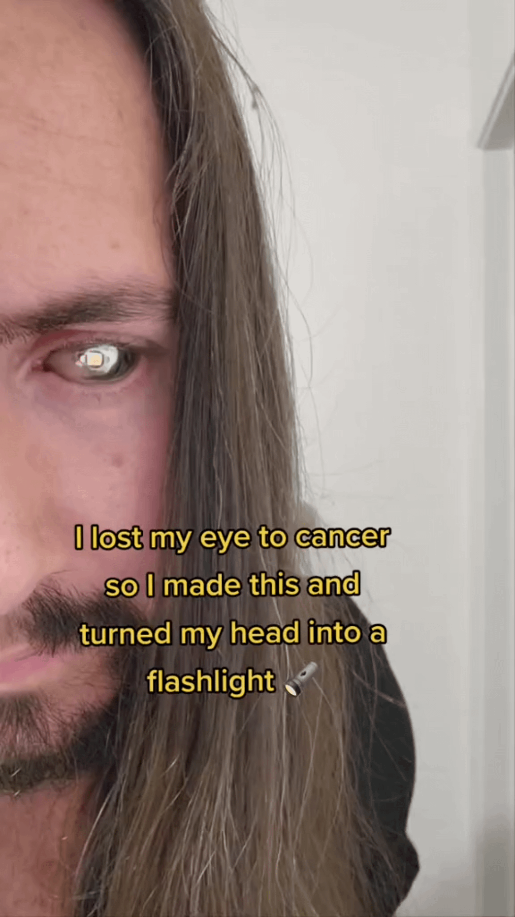 This guy turned his eye into a flashlight. 